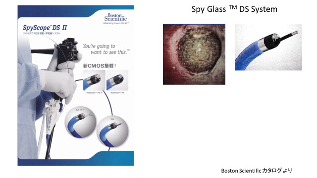 スパイグラスDS 胆管・膵管鏡システムの写真1