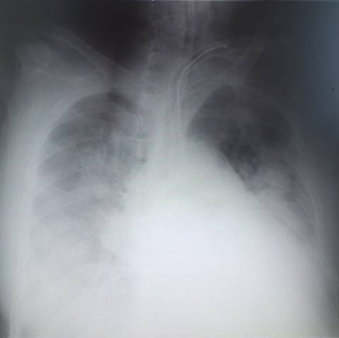 呼吸器リハビリテーションの画像1