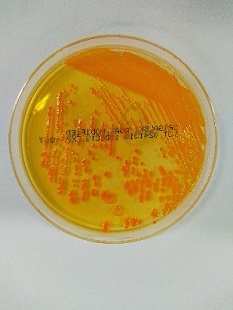 一般細菌検査2日目の画像1