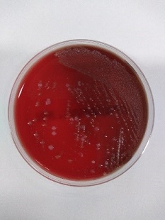 一般細菌検査2日目の画像2