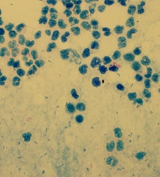 抗酸菌検査の画像1