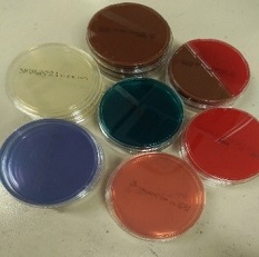 一般細菌検査1日目の画像1