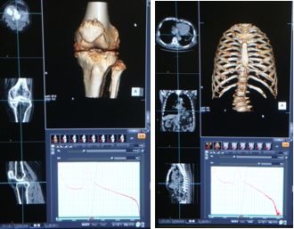 骨系の多断面・3D画像